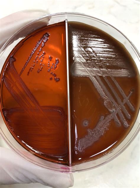 pseudomonas aeruginosa emb|EMB Agar: Composition, Principle, and Colony Morphology.